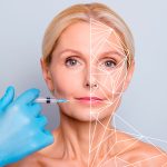 Sculptra can give you multiple benefits associated with your skin