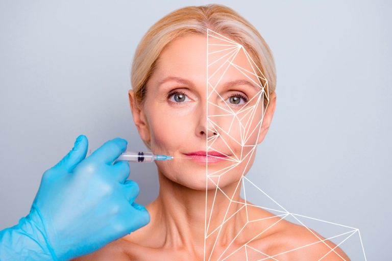 Sculptra can give you multiple benefits associated with your skin