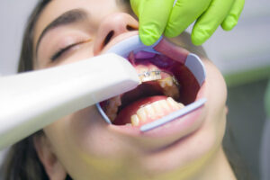 Do you know about the importance of taking care of your teeth