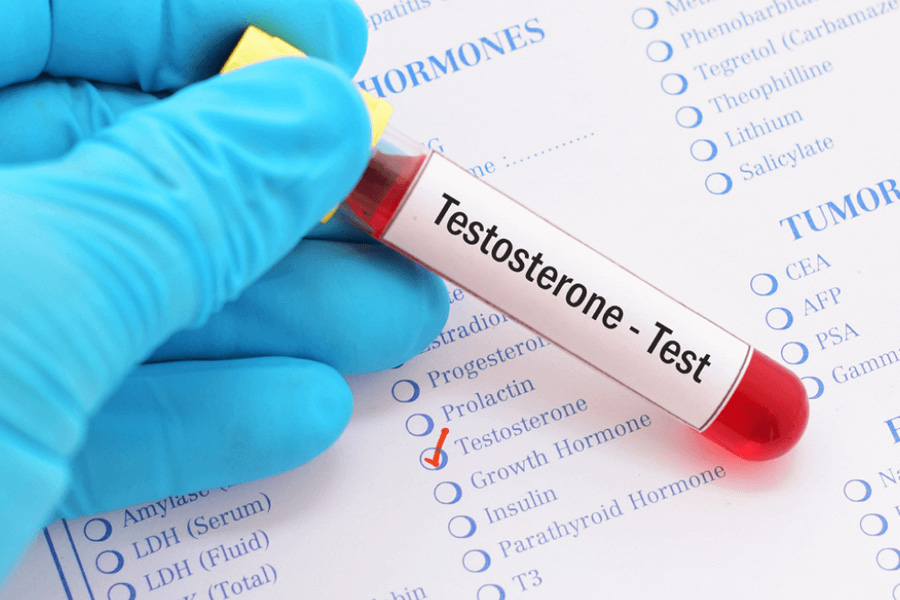 Learn about the importance of healthy testosterone