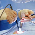 How AI Is Advancing the Selection of Spinal Implant Materials Insights from Dr Larry Davidson