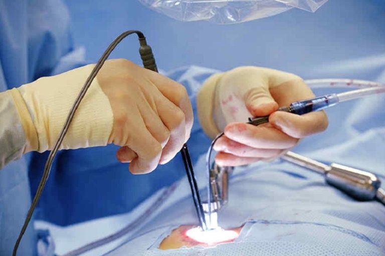 How AI Is Advancing the Selection of Spinal Implant Materials Insights from Dr Larry Davidson