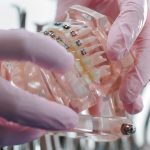 Professional Dentist Services and their Long Lasting Oral Health