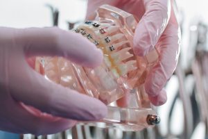 Professional Dentist Services and their Long Lasting Oral Health